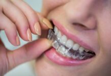 La ortodoncia invisible gana terreno frente a los brackets tradicionales