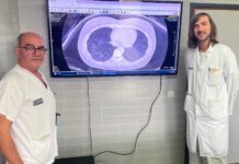 El Hospital de Sant Joan lidera un avance en IA para anticipar el tratamiento del asma grave y mejorar la lectura de los TAC