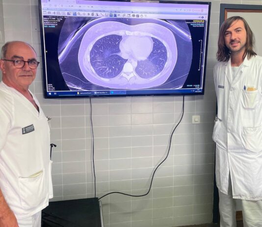 El Hospital de Sant Joan lidera un avance en IA para anticipar el tratamiento del asma grave y mejorar la lectura de los TAC